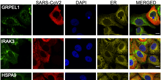 Large scale immunofluorescence to explore the host cell response to SARS-CoV-2 infection